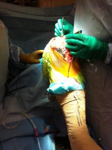 Doc took this durning surgery. Awesome.