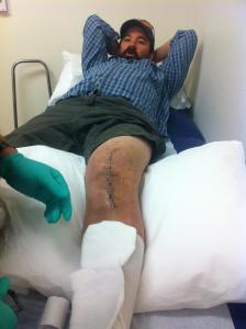 Day 15. Staples are halfway out!